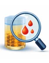 Blood in urine