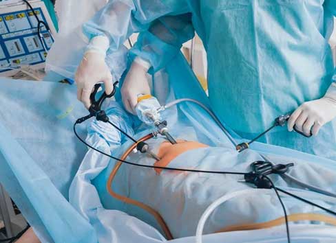 TURP Surgery